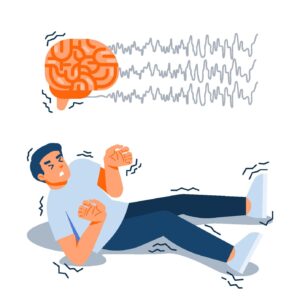 DIAGNÓSTICO E TRATAMENTO DA EPILEPSIA